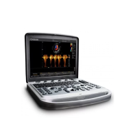 Портативний УЗД апарат Chison SonoBook 8